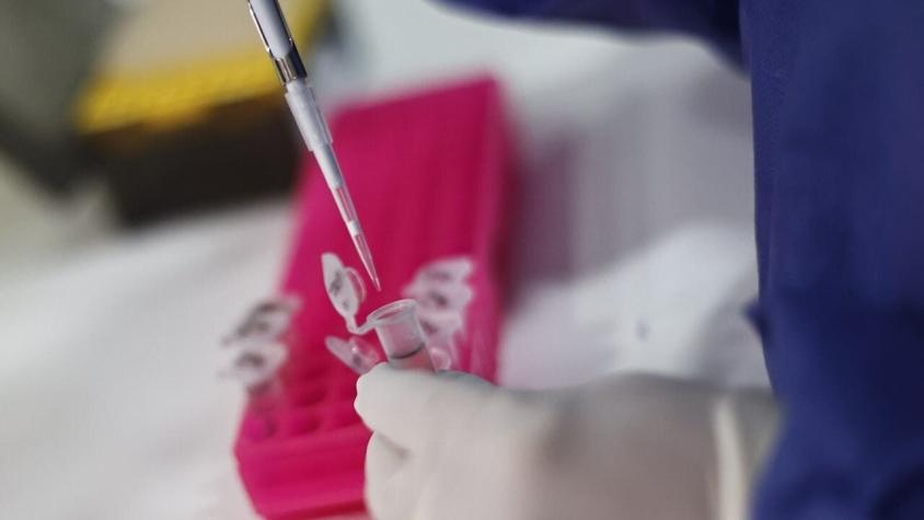 Minsal confirma vacunación contra la viruela del mono en Chile