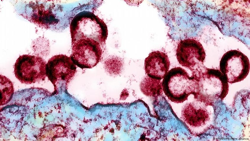 Científicos prueban una nueva estrategia de vacunación para combatir el VIH