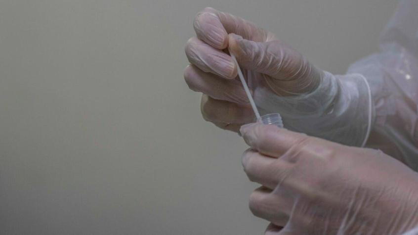 Antígeno en tres pasos: Revisa en qué farmacias puedes encontrar los kits de autotest