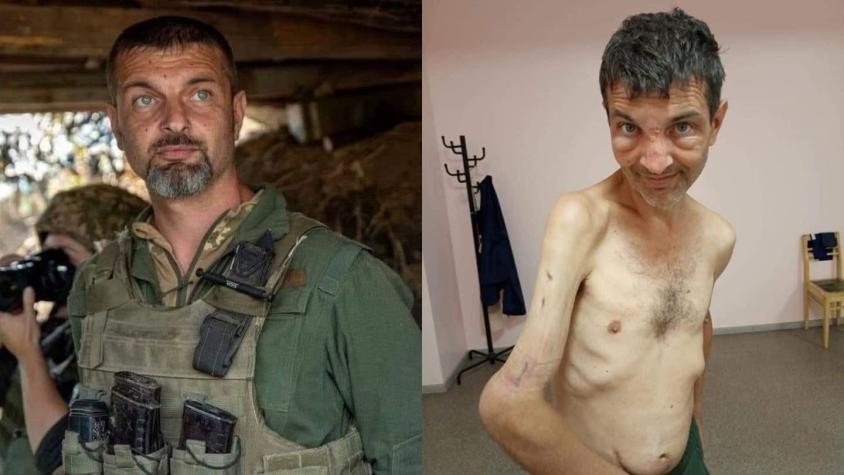 El impactante cambio físico de un soldado ucraniano que fue liberado tras intercambio de prisioneros