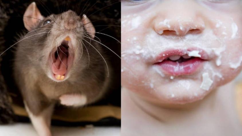 Madre encuentra a rata mordiéndole la cara a su hijo de dos años en Reino Unido