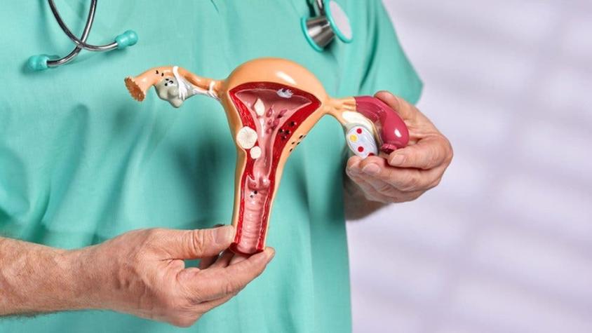 El síndrome que provoca que las mujeres nazcan sin útero y canal vaginal