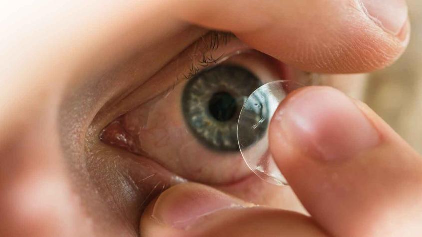 "Nunca había visto algo así": Doctora retiró 23 lentes de contacto del ojo de una mujer