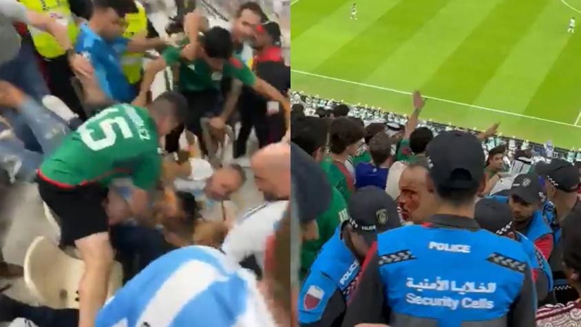 El impactante estado en que quedó un argentino tras brutal golpiza de hinchas mexicanos