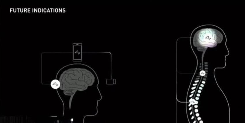 [VIDEO] +100CIA: Elon Musk quiere instalar su chip cerebral en humanos