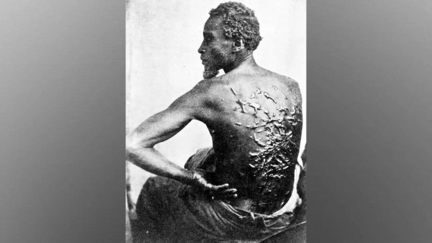 La historia de "Peter azotado", el esclavo cuya fotografía cambió la percepción de la esclavitud