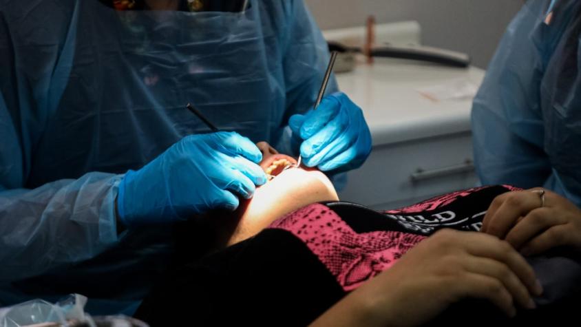 Informe de la OMS posiciona a Chile entre los países con mayor prevalencia de caries sin tratar