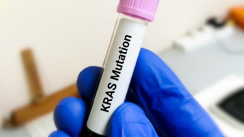 KRAS, la proteína "maldita" del cáncer que es objetivo de investigaciones para tratamientos modernos