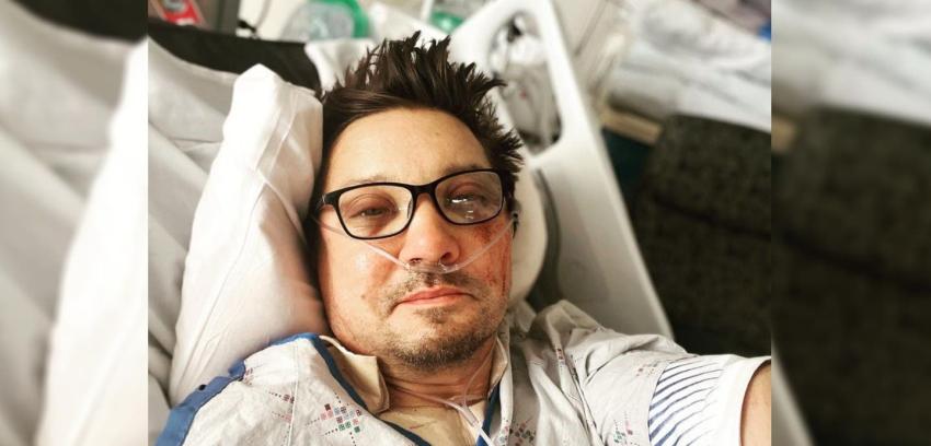 Jeremy Renner actualiza su estado de salud y publica su primera selfie tras grave accidente