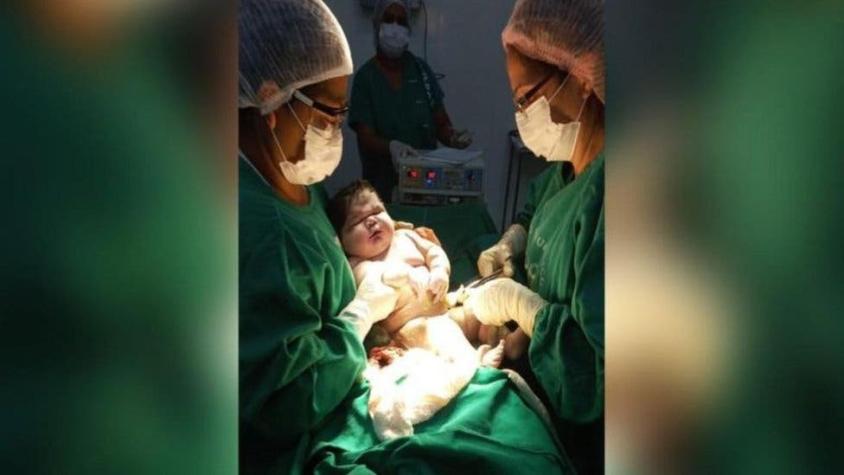 Nace un "bebé gigante" de 7,3 kg en Brasil: cuáles son las causas y los riesgos de la macrosomía