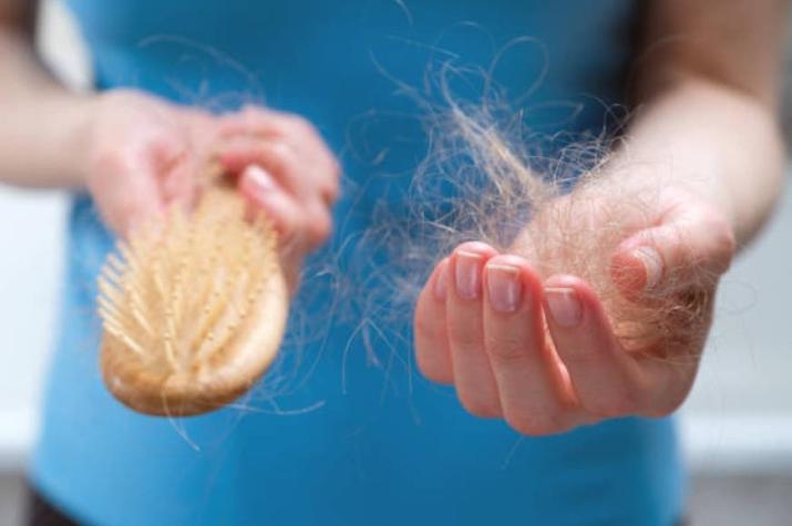 Mujeres denuncian que popular producto para el cabello les generó calvicie y ampollas