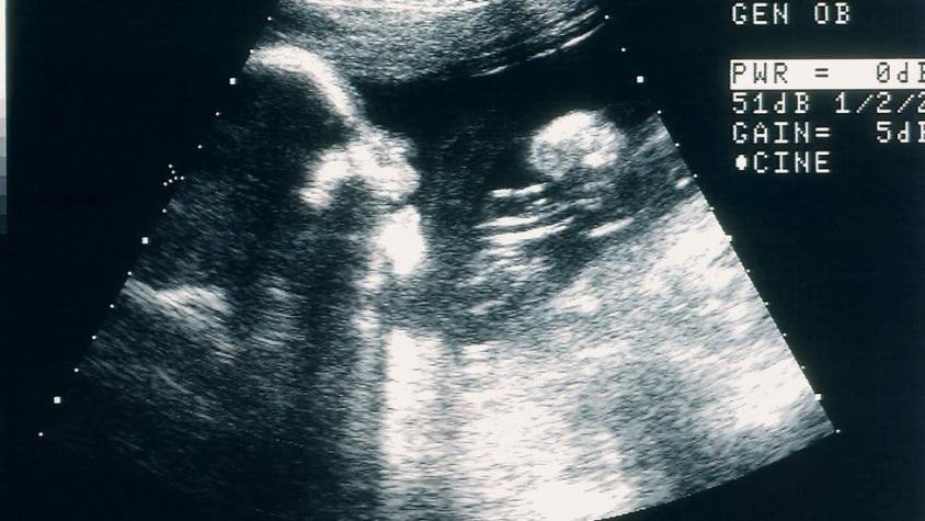 "La regla de los 3 meses": por qué muchas mujeres esperan a la semana 12 para anunciar su embarazo