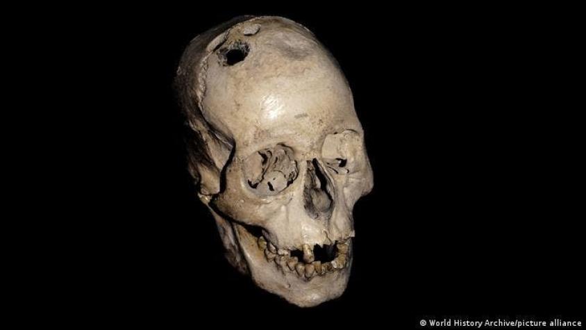 Estudio revela que la cirugía cerebral se remonta a la Edad de Bronce