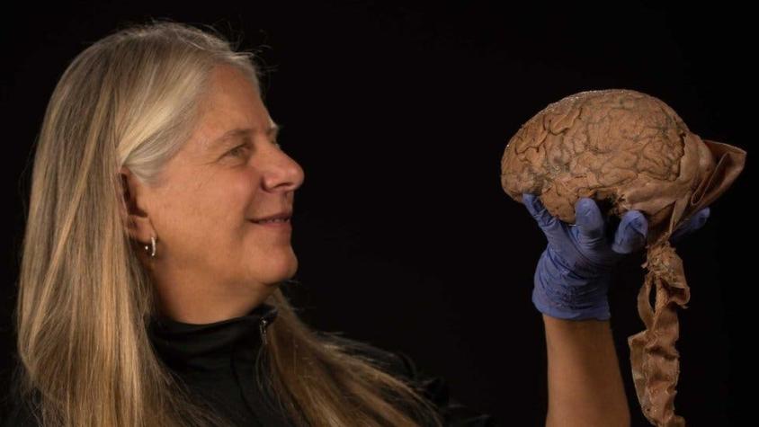 La científica que por un derrame cerebral que la paralizó temporalmente hizo un gran descubrimiento