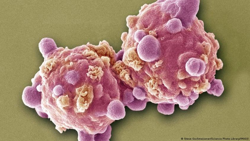 Una pastilla experimental logra remitir la leucemia avanzada en 18 pacientes