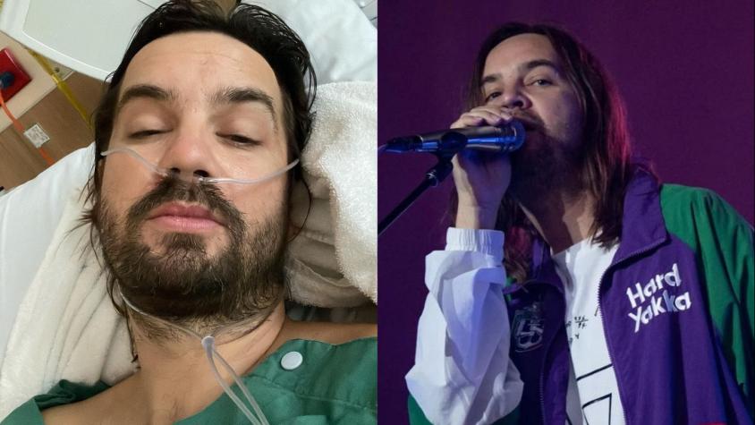 Kevin Parker (Tame Impala) aclara qué pasará con shows en Sudamérica tras fracturarse la cadera a días de Lollapalooza