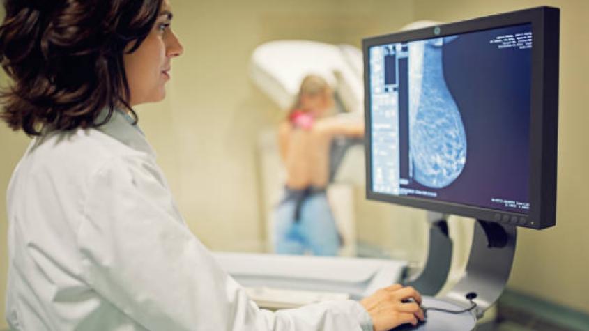 Comienza a regir ley que permite acceso a mamografías sin una orden médica