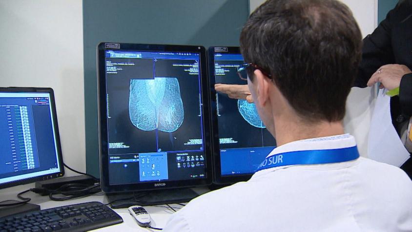 [VIDEO] Mamografías ya no requieren orden médica para mujeres entre 50 y 69 años