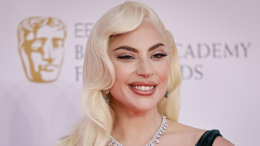 Lady Gaga, impacto, nueva boca y dientes, irreconocible