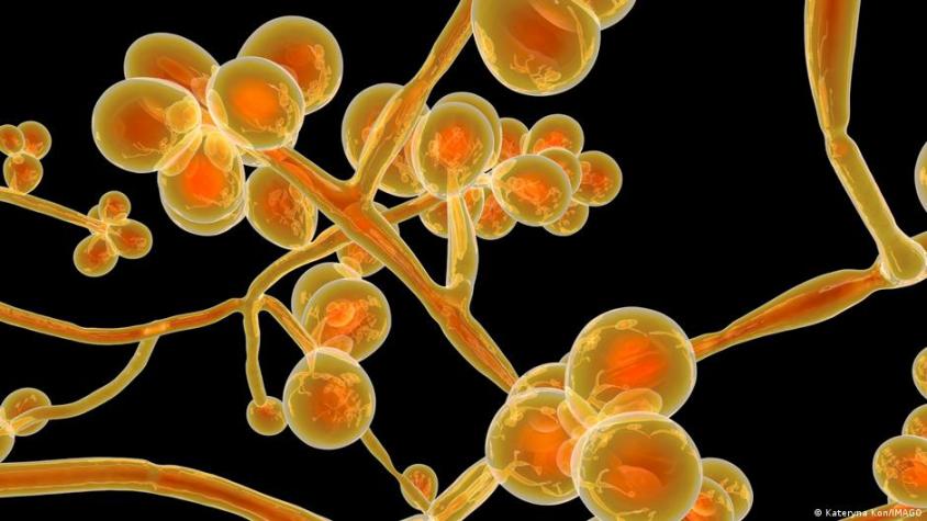 Candida auris: Propagación de un peligroso hongo inquieta a la medicina