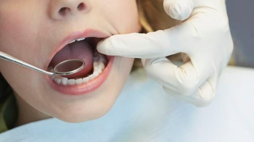 Niña de 15 años muere durante procedimiento dental en clínica de Puerto Montt