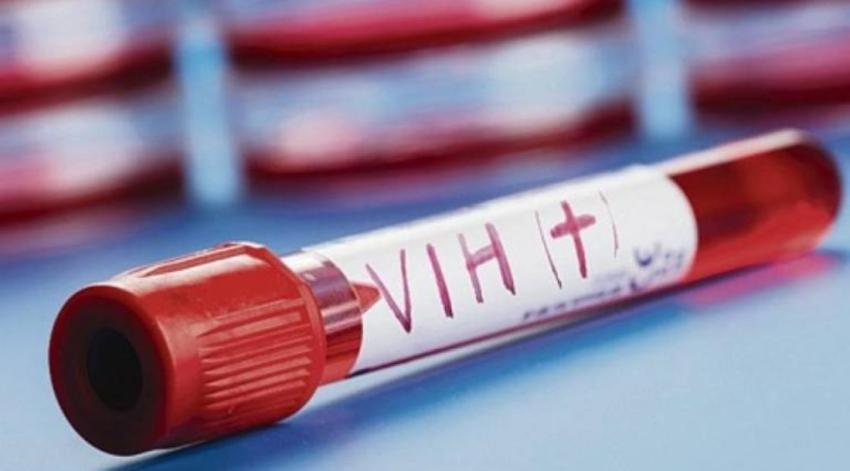 Esperanzador: científicos descubren una proteína que podría acabar con el VIH