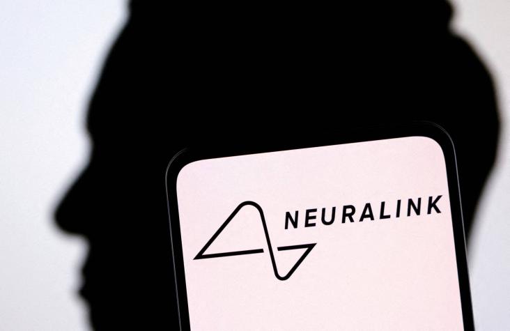 Neuralink afirma que Elon Musk tiene permiso para probar sus implantes cerebrales en humanos