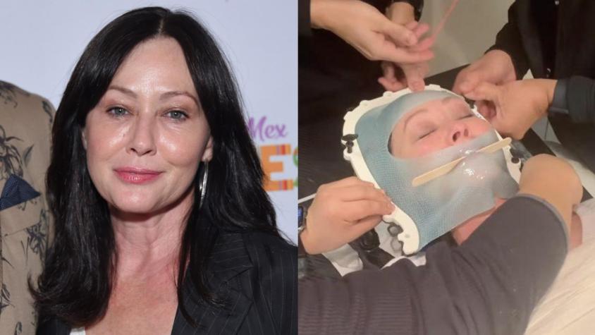 Shannen Doherty contó que tiene metástasis en el cerebro con duro video de su primer día de radioterapia: "Estoy aterrada"