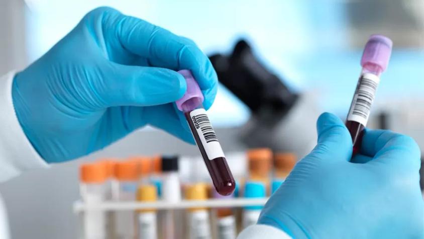 El prometedor examen de sangre para detectar cáncer que tiene entusiasmados a los científicos