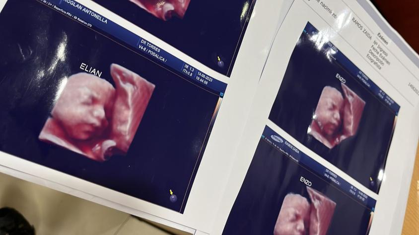 Denuncian que clínica usaba foto de una misma ecografía 5D para todas las embarazadas: caso salió a la luz en redes sociales