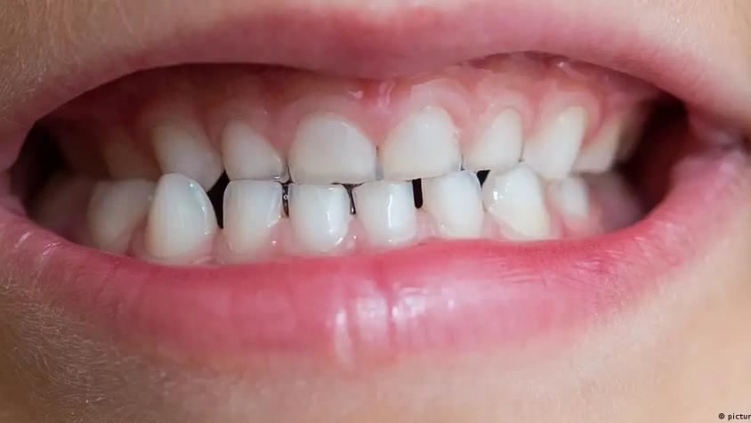 Prometedor avance: fármaco podría regenerar dientes