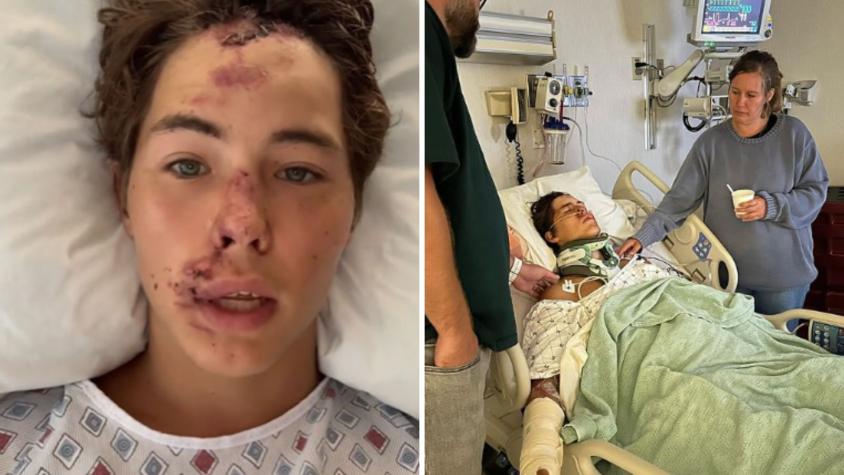 Tiktoker se salvó de milagro tras caer por acantilado de 24 metros: "Casi muero"