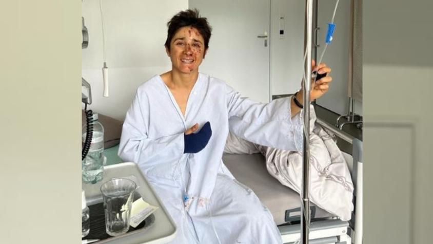 Barbára Riveros sufrió grave accidente en bicicleta en Suiza: Chocó contra un vehículo y terminó en el parabrisas