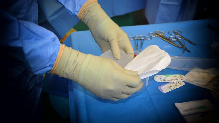Mujer murió tras fallida cirugía de implante mamario realizada en su casa en Puente Alto