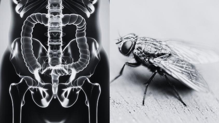 Hombre se hace una colonoscopía y médicos descubren mosca volando en su intestino: "Representa un hallazgo muy poco frecuente"