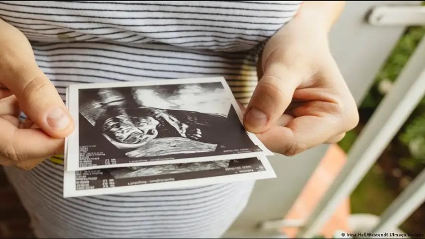 Mujer nacida con dos úteros está embarazada en ambos