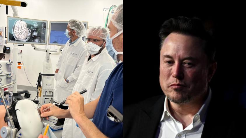Telepathy: En qué consiste el microchip cerebral que implantó Neuralink, la empresa de Elon Musk