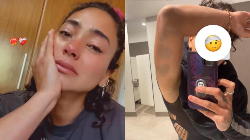 "No sé si reír o llorar": Hermano de Camila Recabarren entregó su versión sobre acusación de haberla golpeado