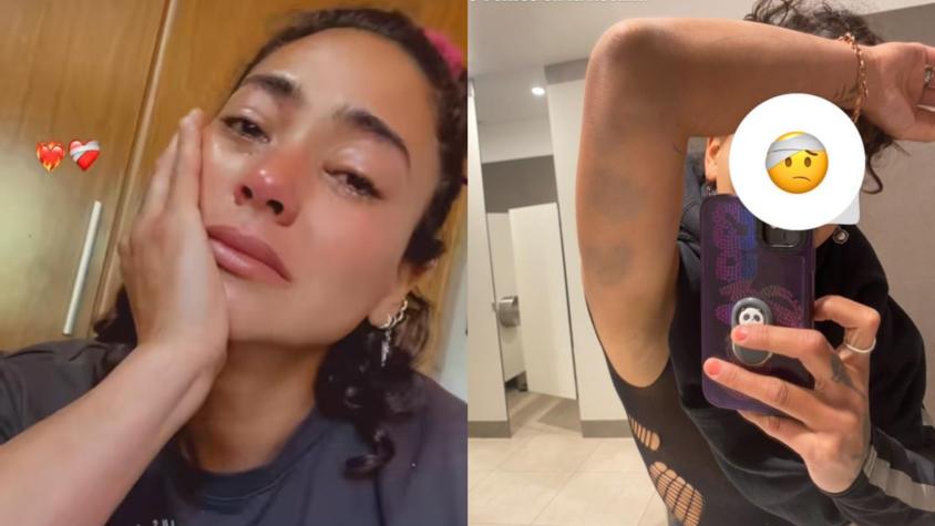 "No sé si reír o llorar": Hermano de Camila Recabarren entregó su versión sobre acusación de haberla golpeado "No sé si reír o llorar": Hermano de Camila Recabarren entregó su versión sobre acusación de haberla golpeado