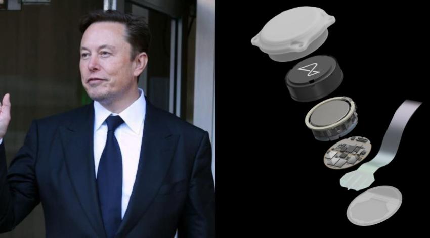 Neuralink, empresa de Elon Musk, implanta el primer chip cerebral en un humano: ¿Para qué sirve este aparato?