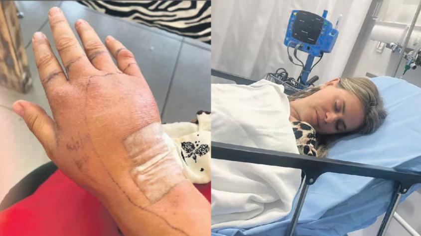 Eliana Albasetti es hospitalizada tras sufrir accidente mientras rescataba animales en Viña del Mar