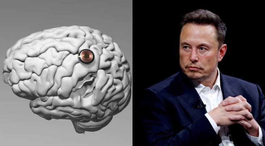 Experto asegura que Elon Musk podría hacer "un mal uso de los chips cerebrales" de Neuralink