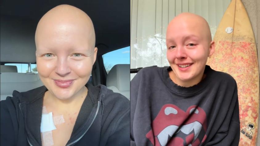Joven de 26 años pensó que tenía un virus, pero era cáncer terminal: ahora cuenta su vida en TikTok