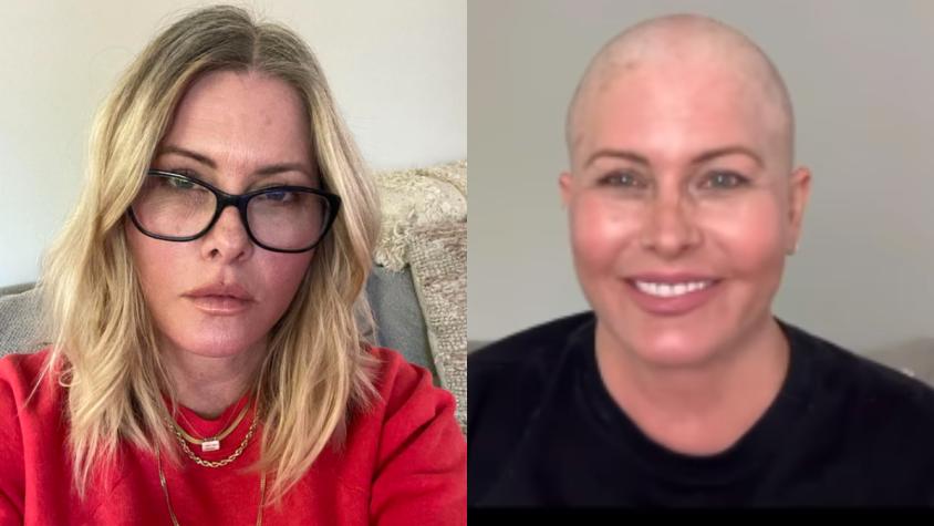 Nicole Eggert se rapó su cabeza tras ser diagnosticada de cáncer de mama
