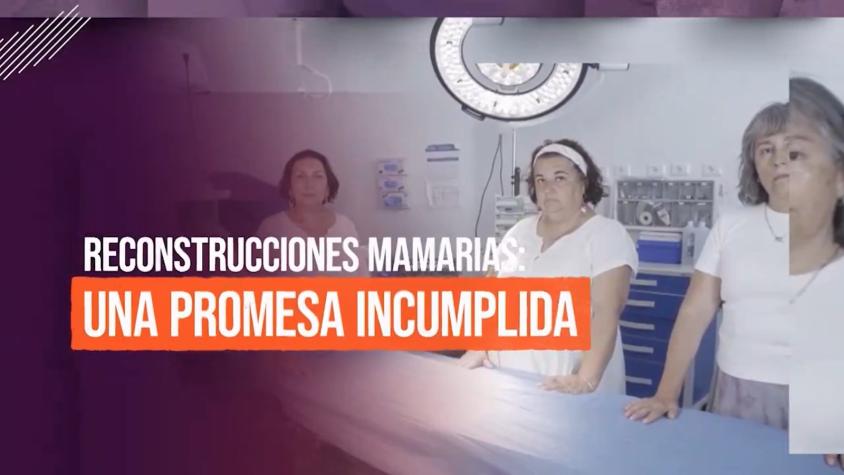 Reportajes T13: Mujeres en lista de espera hasta 21 años por una reconstrucción mamaria