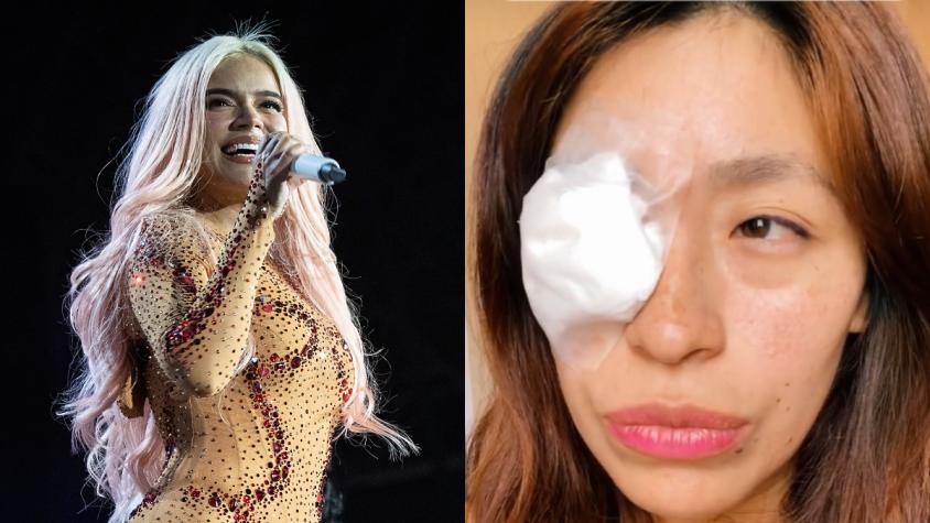 Fan peruana dice que sufrió heridas en su ojo por pirotecnia en show de Karol G