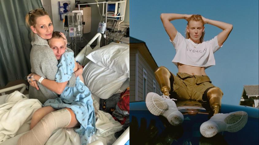 Mujer pierde ambas piernas por "shock tóxico" de un tampón