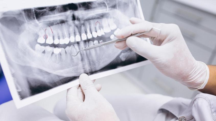 Medicina dental del sueño: así puede ayudar el odontólogo a que durmamos mejor