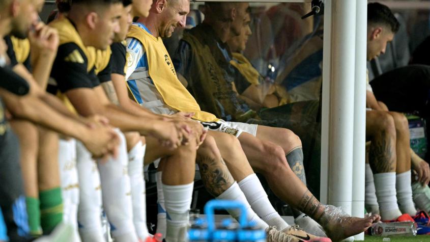 Impactante: Así quedó el tobillo derecho de Lionel Messi tras abandonar lesionado la final de Copa América