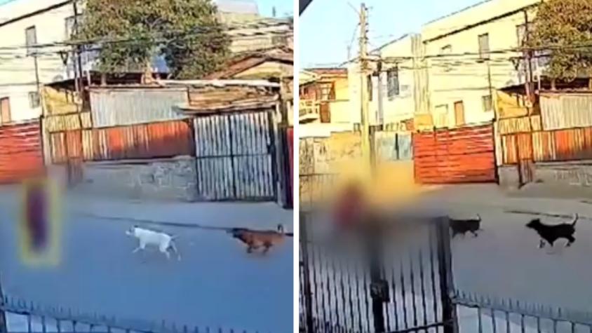 Mujer fue brutalmente mordida por cuatro perros en Llolleo: vecinos denuncian más de 50 ataques